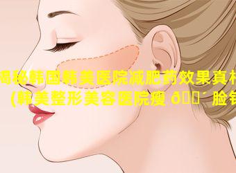 揭秘韩国韩美医院减肥药效果真相(韩美整形美容医院瘦 🌴 脸针多少钱)